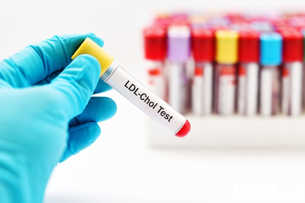 LDL低密度脂蛋白测试.jpg